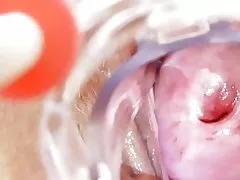 Y tá bẩn thỉu được solo